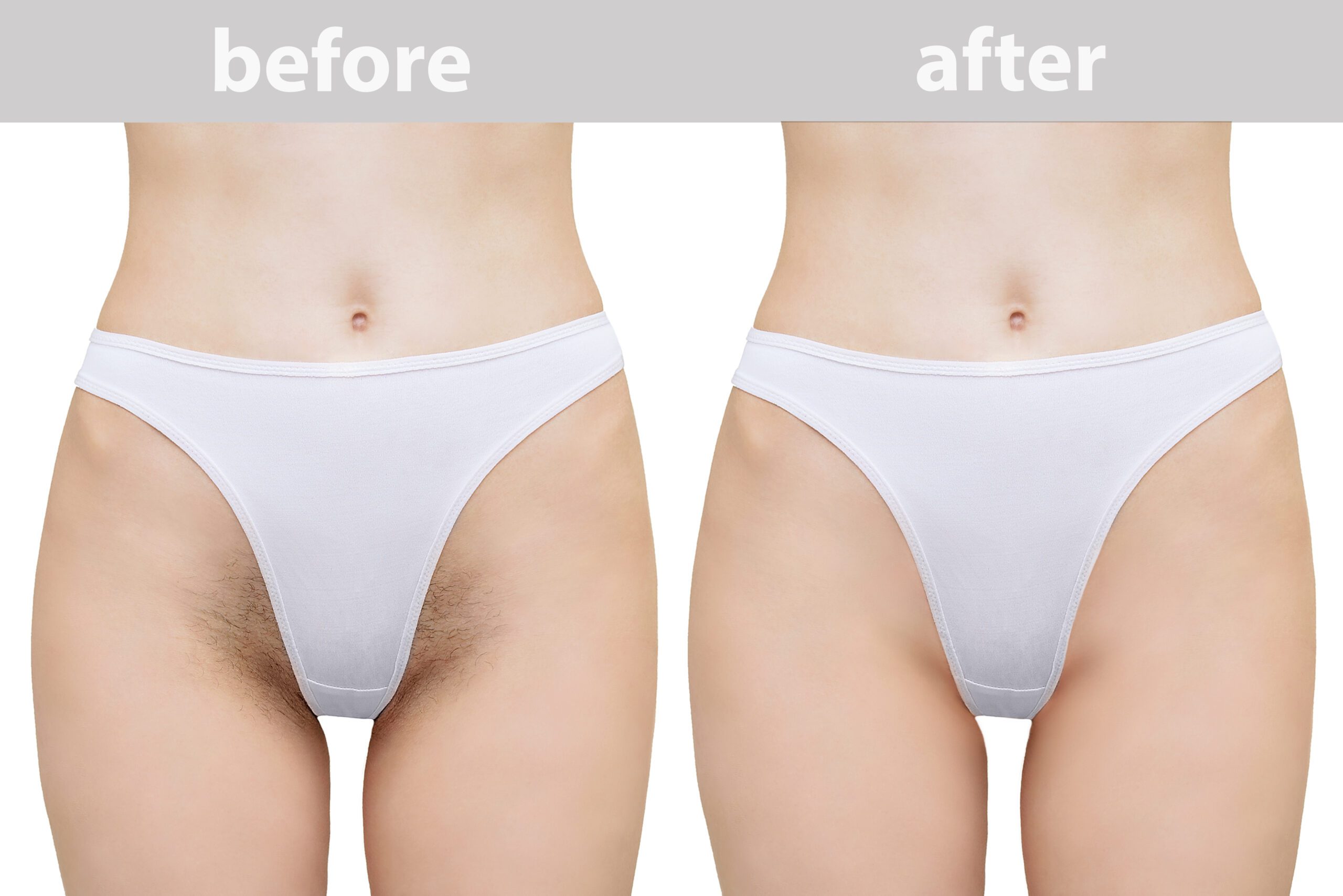 bikini waxing before and after