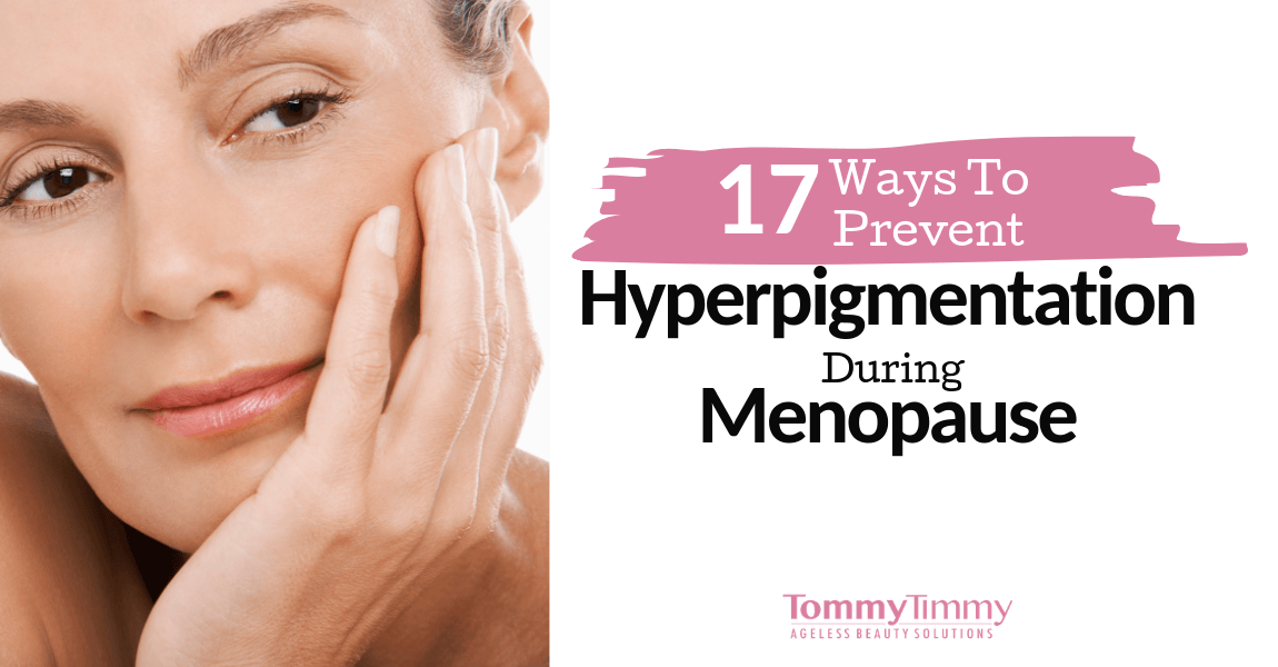hyperpigmentation during menopause