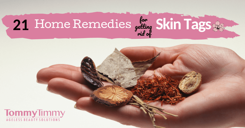 21 home remedies to get rid of skin tags