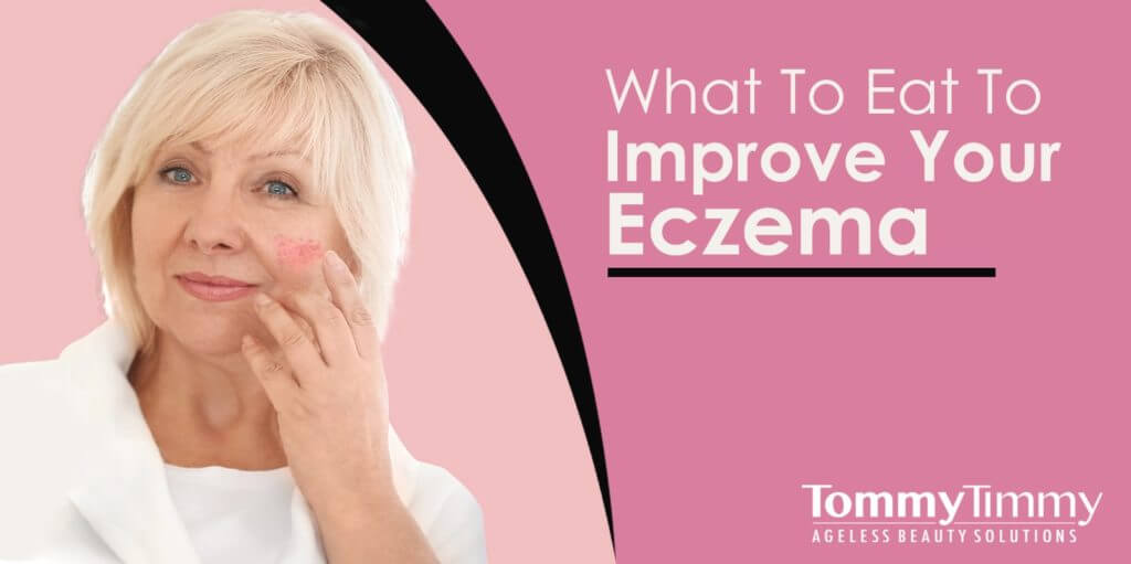 What To Eat To Improve Your Eczema-min