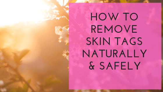 How to Remove Skin Tags Naturally & Safely