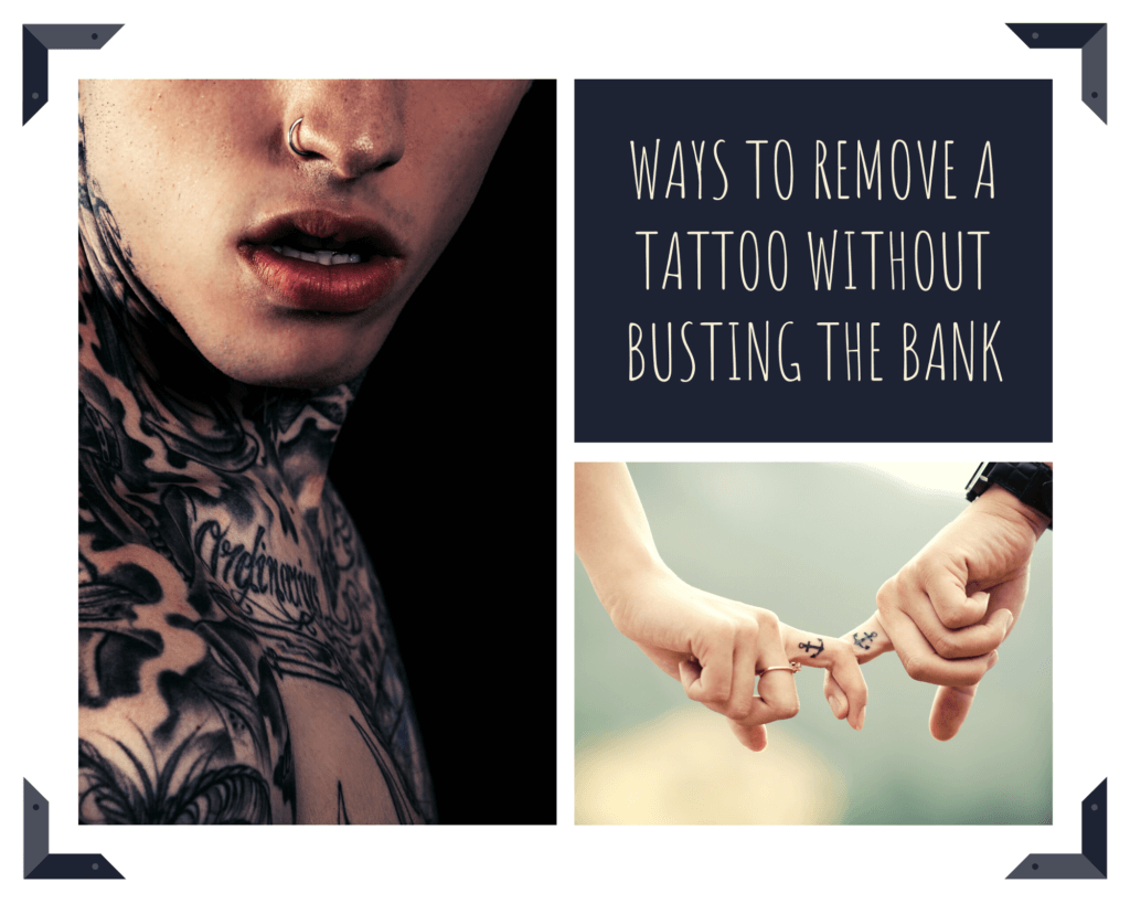 Best Ways To Remove A Tattoo
