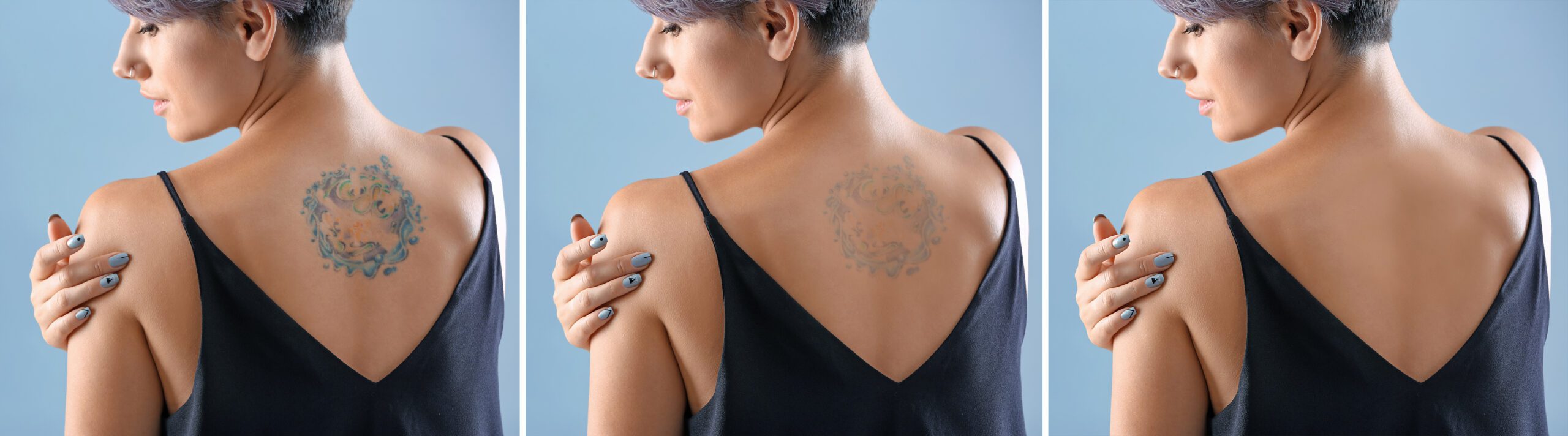Woman showing fading tattoo