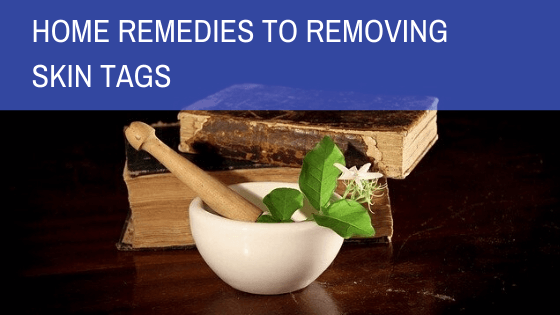 Effective DIY Remedies To Remove Skin Tags