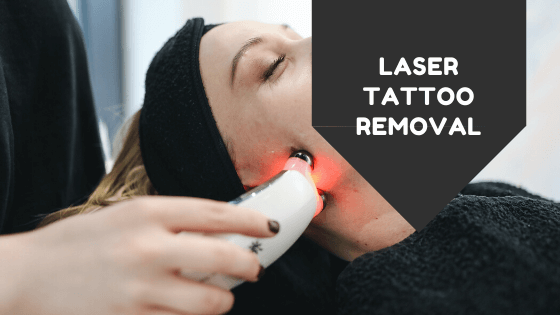 Laser Tattoo Removal. Does it work?