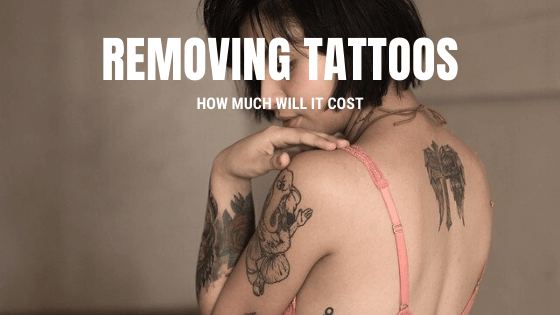 Tattoo Removal – How Much Will It Cost