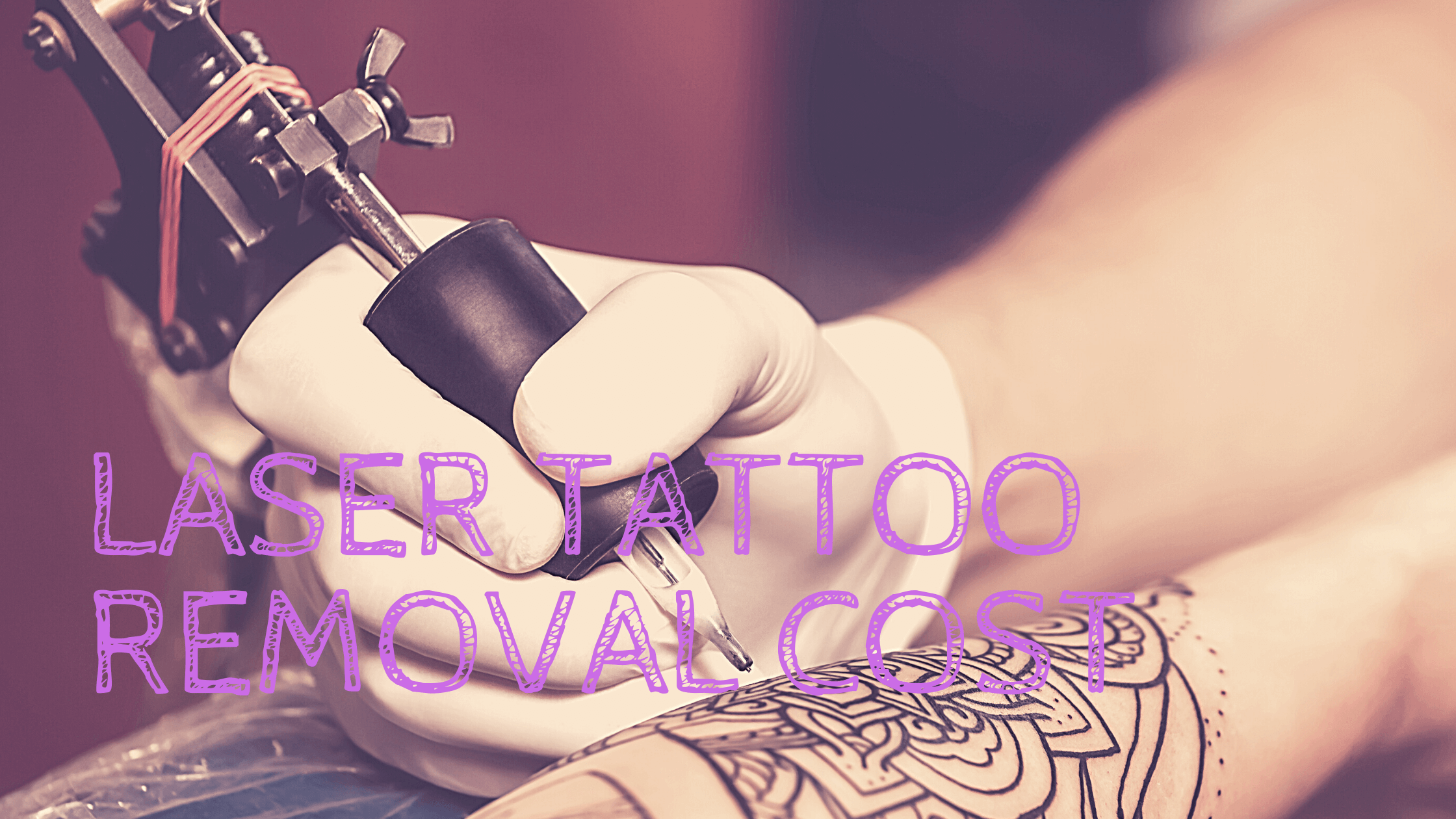 Laser Tattoo Removal Cost