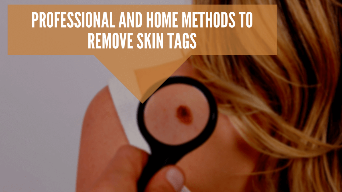 Professional and Home Methods to Remove Skin Tags