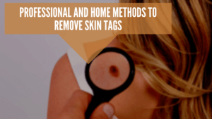 Remove Skin Tags Professionally