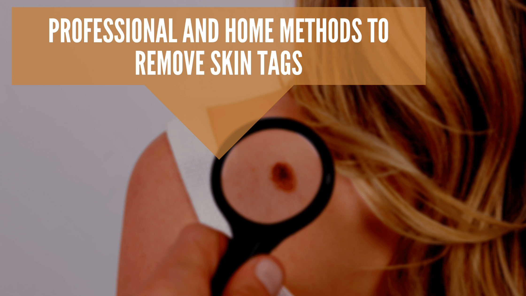 Remove Skin Tags Professionally